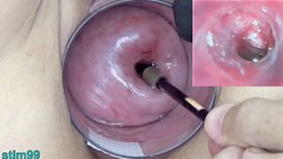 Hot Japanese Nurse Inspects Mature Wife's Private🤫 Parts with Endoscope