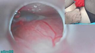 Uncensored: Japanese Insemination with Cervical Camera