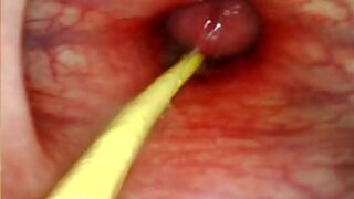 Ultra Explicit Anal👌 View: Deep Cock🍆 Slam & Cumshot Inside Her Ass🍑