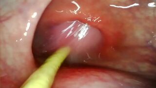 INSIDE HER ASS🍑 WITH MY BLOOMSTICK POUNDING, DEEP ANAL👌 PLEASURE