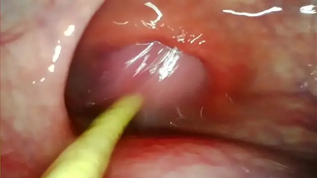 EXTREME ANAL POV  CAMERA INSIDE HER ASSHOLE AS I POUND HER WITH MY BIG COCK AND CUM DEEP INSIDE