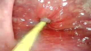 Deep Anal👌 pounding with Big Cock🌭, Extreme Cumshot POV