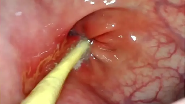 EXTREME ANAL POV  CAMERA INSIDE HER ASSHOLE AS I POUND HER WITH MY BIG COCK AND CUM DEEP INSIDE