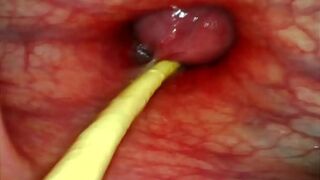 EXTREME ANAL POV  CAMERA INSIDE HER ASSHOLE AS I POUND HER WITH MY BIG COCK AND CUM DEEP INSIDE